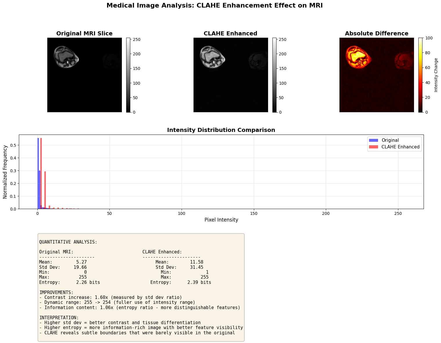 ../../../_images/examples_image_processing_clahe_dynamic_mode_14_1.png