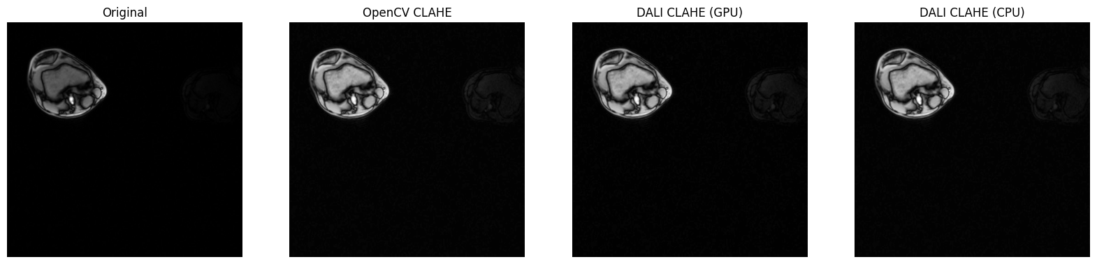 ../../../_images/examples_image_processing_clahe_pipeline_mode_15_0.png