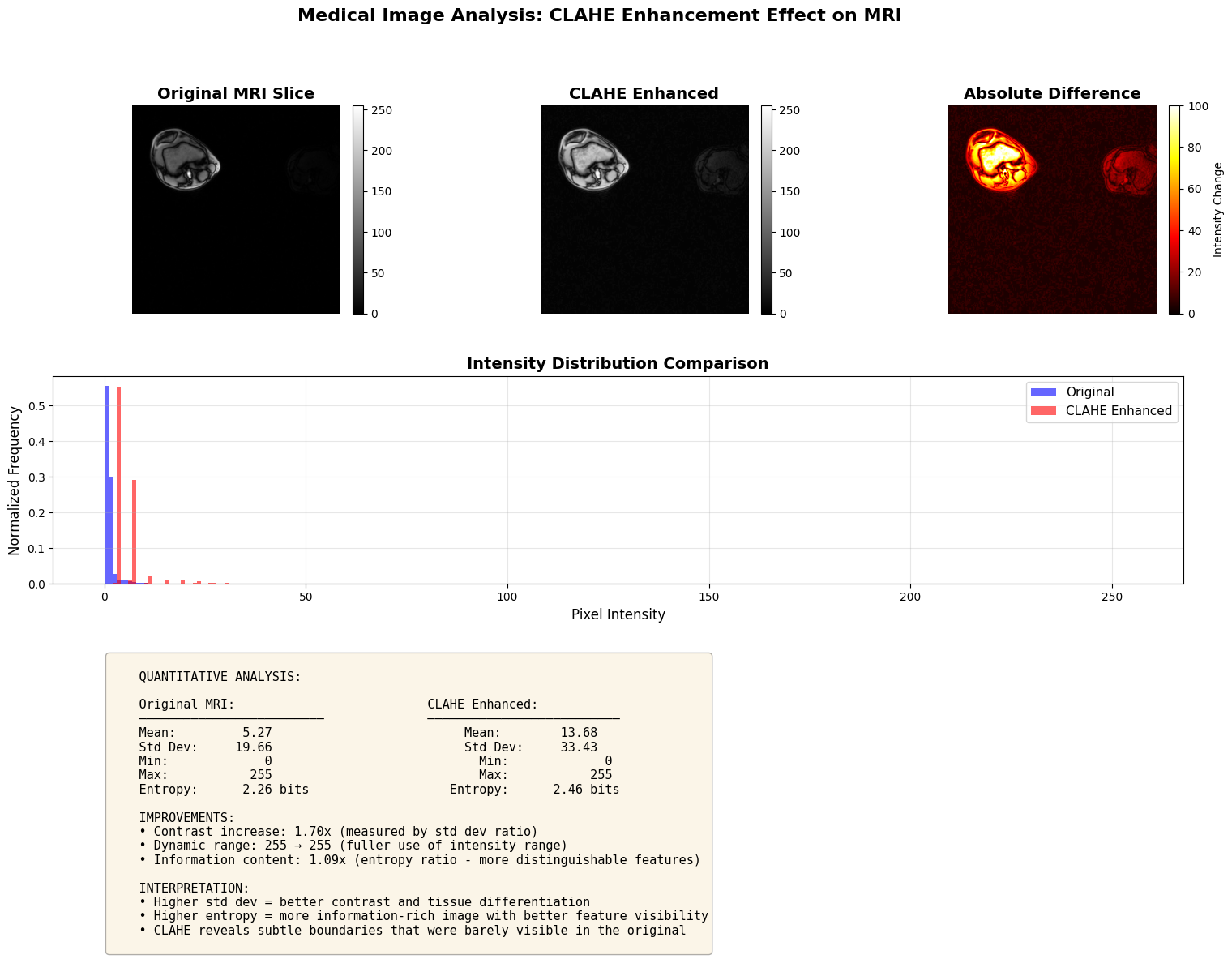 ../../../_images/examples_image_processing_clahe_pipeline_mode_20_0.png