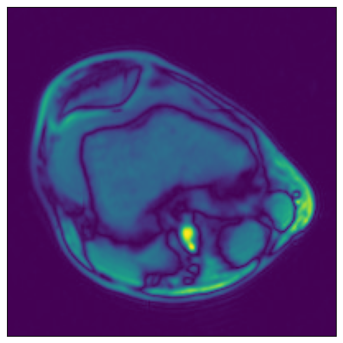 ../../../../_images/examples_general_data_loading_numpy_reader_dynamic_mode_19_0.png