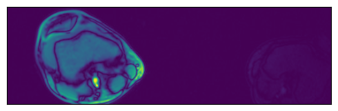 ../../../../_images/examples_general_data_loading_numpy_reader_dynamic_mode_23_0.png