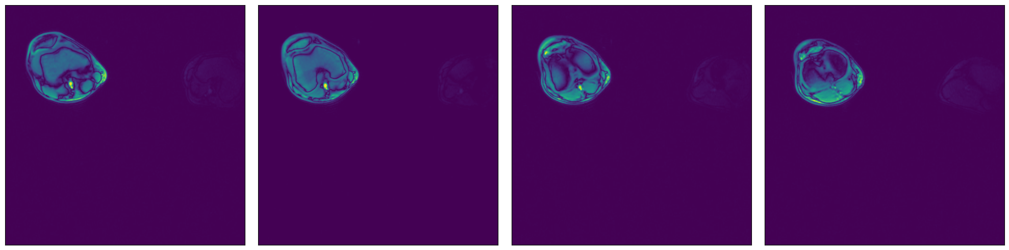 ../../../../_images/examples_general_data_loading_numpy_reader_dynamic_mode_6_0.png