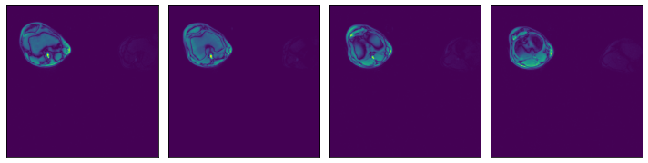 ../../../../_images/examples_general_data_loading_numpy_reader_pipeline_mode_6_0.png