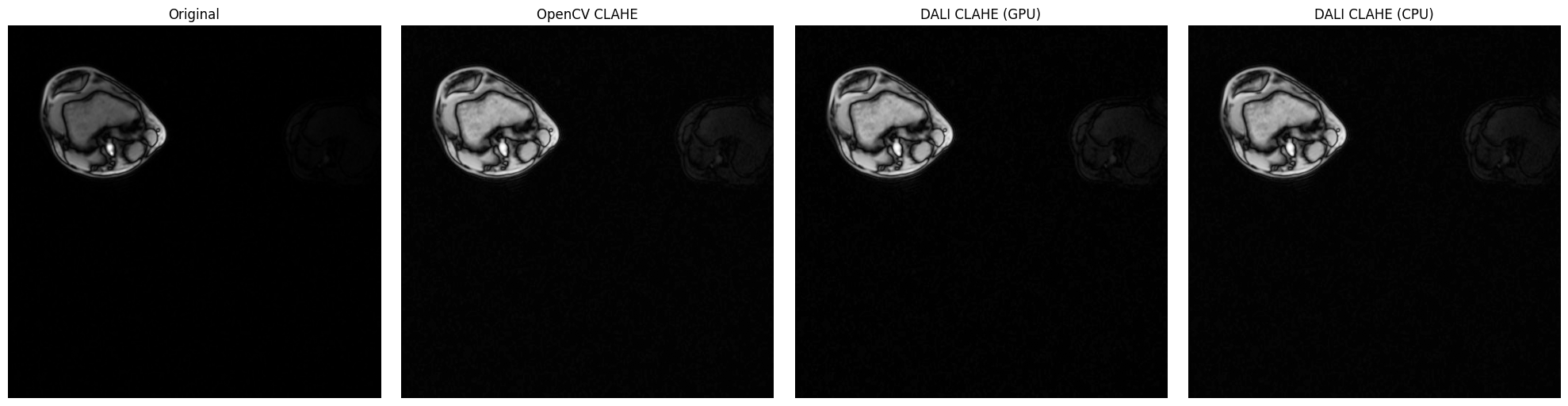 ../../../_images/examples_image_processing_clahe_dynamic_mode_11_0.png