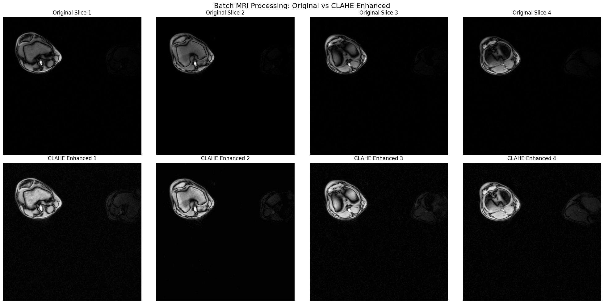 ../../../_images/examples_image_processing_clahe_dynamic_mode_16_1.png