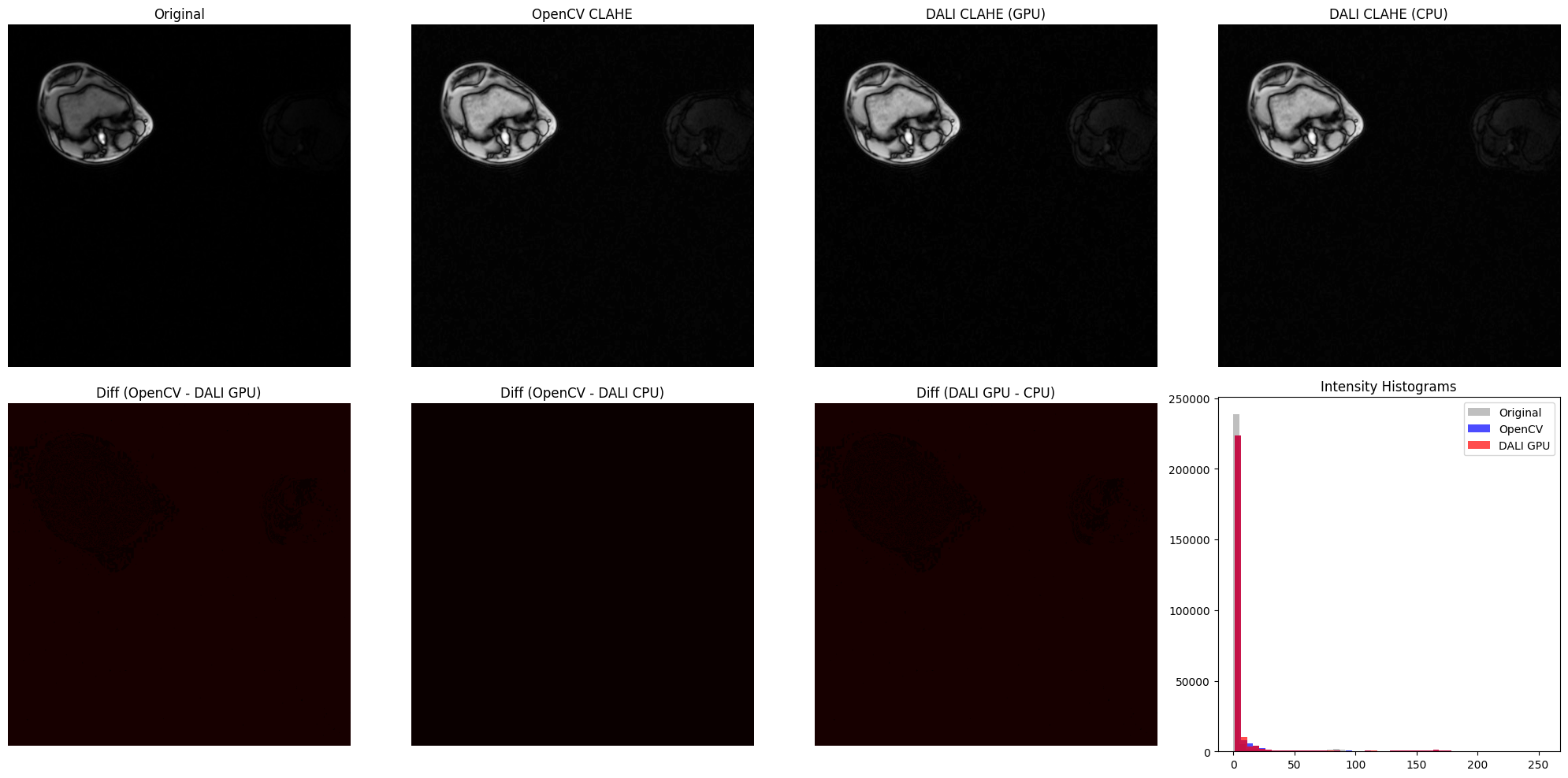 ../../../_images/examples_image_processing_clahe_pipeline_mode_16_0.png