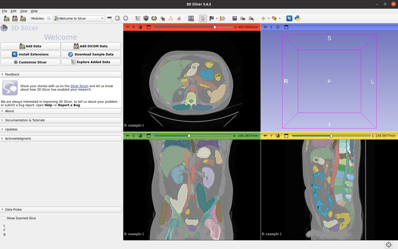 3D Slicer Rendering Example 4