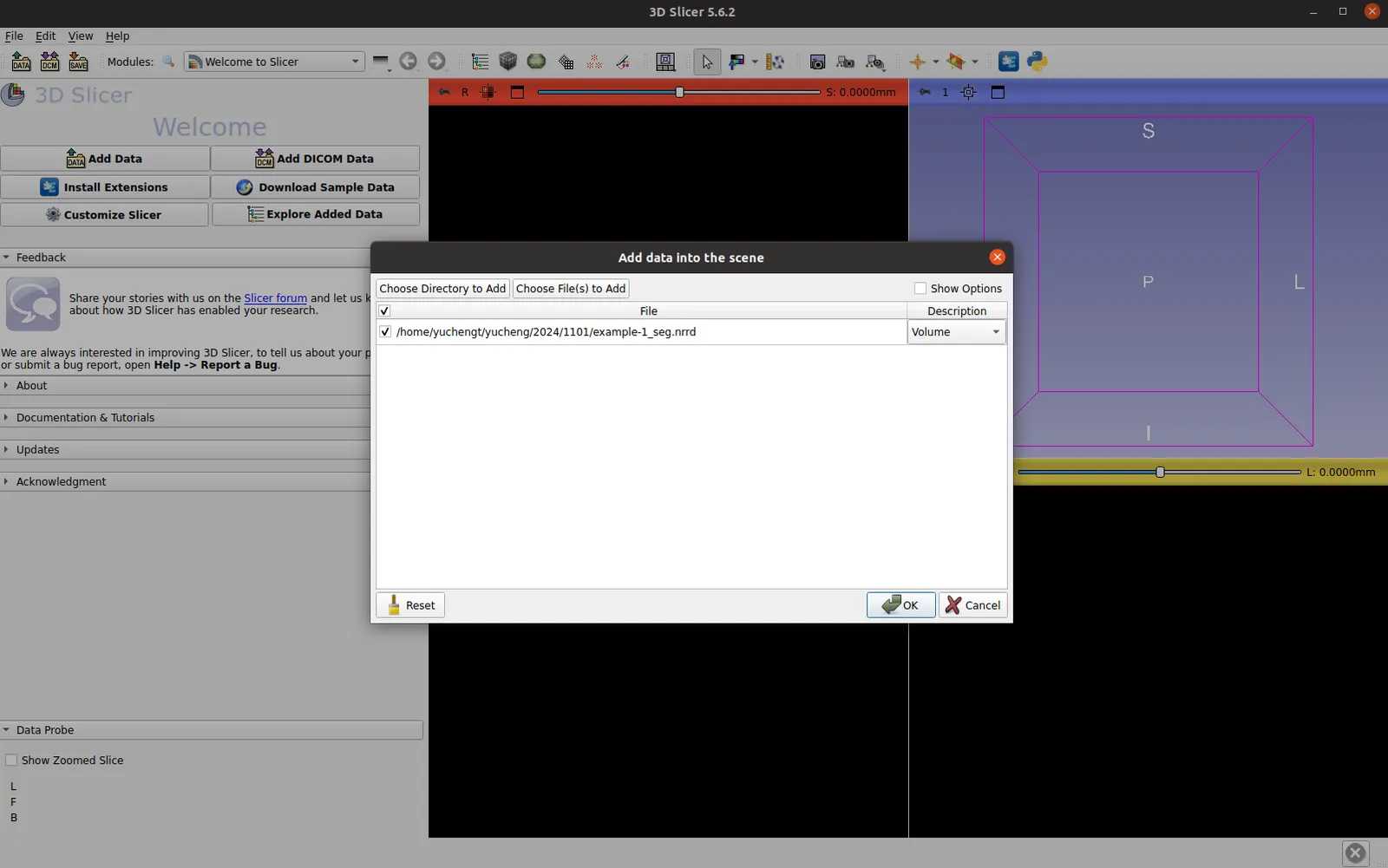 3D Slicer Rendering Example 2