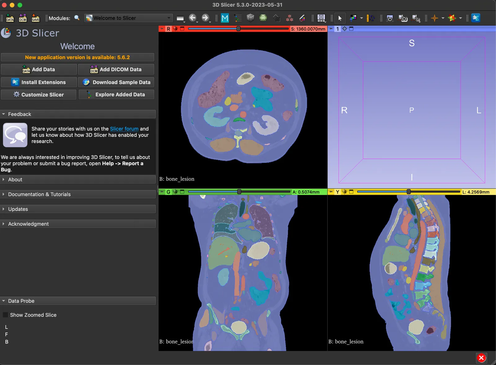 3D Slicer Rendering Example 4