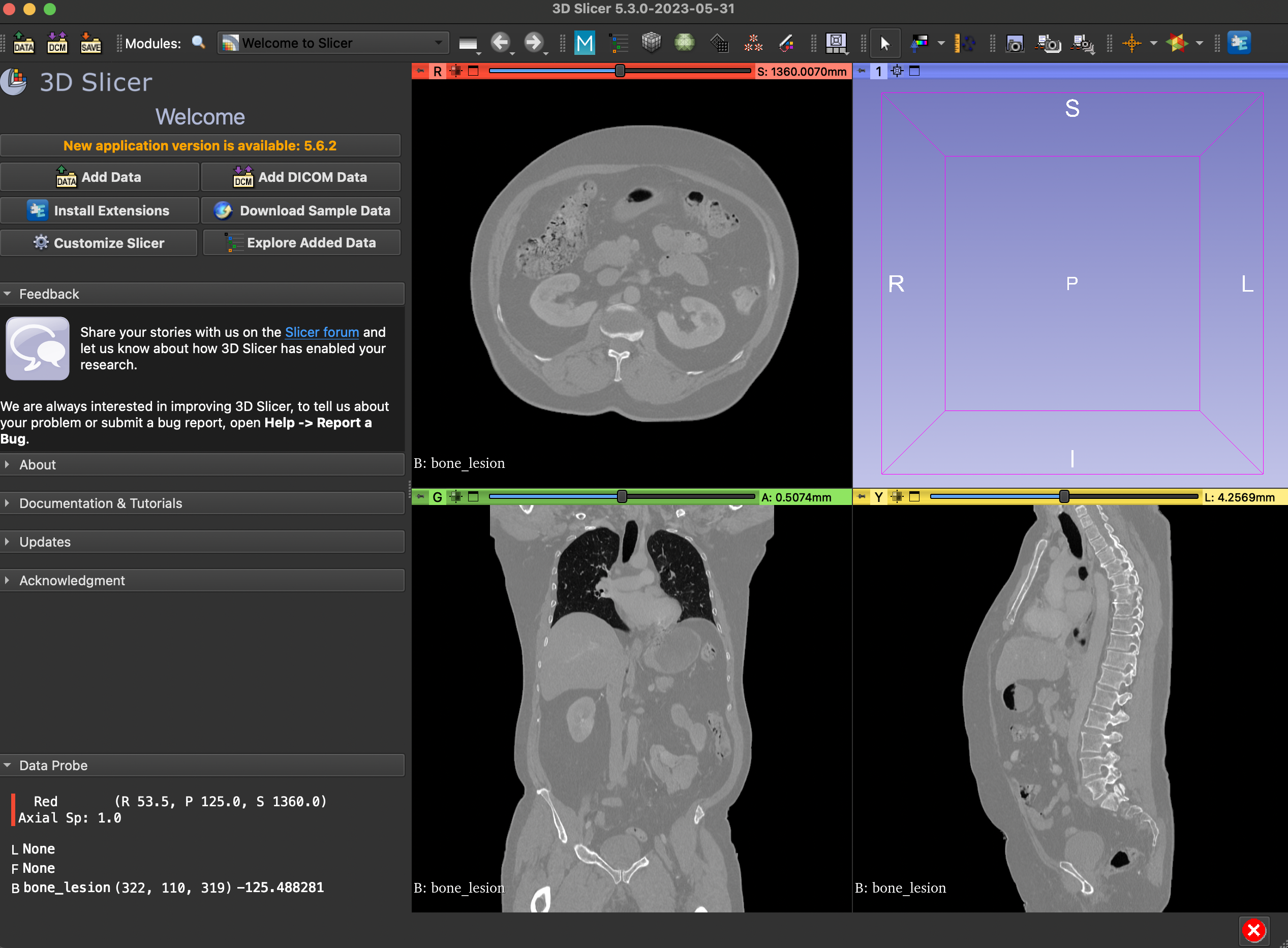 3D Slicer Rendering Example 2