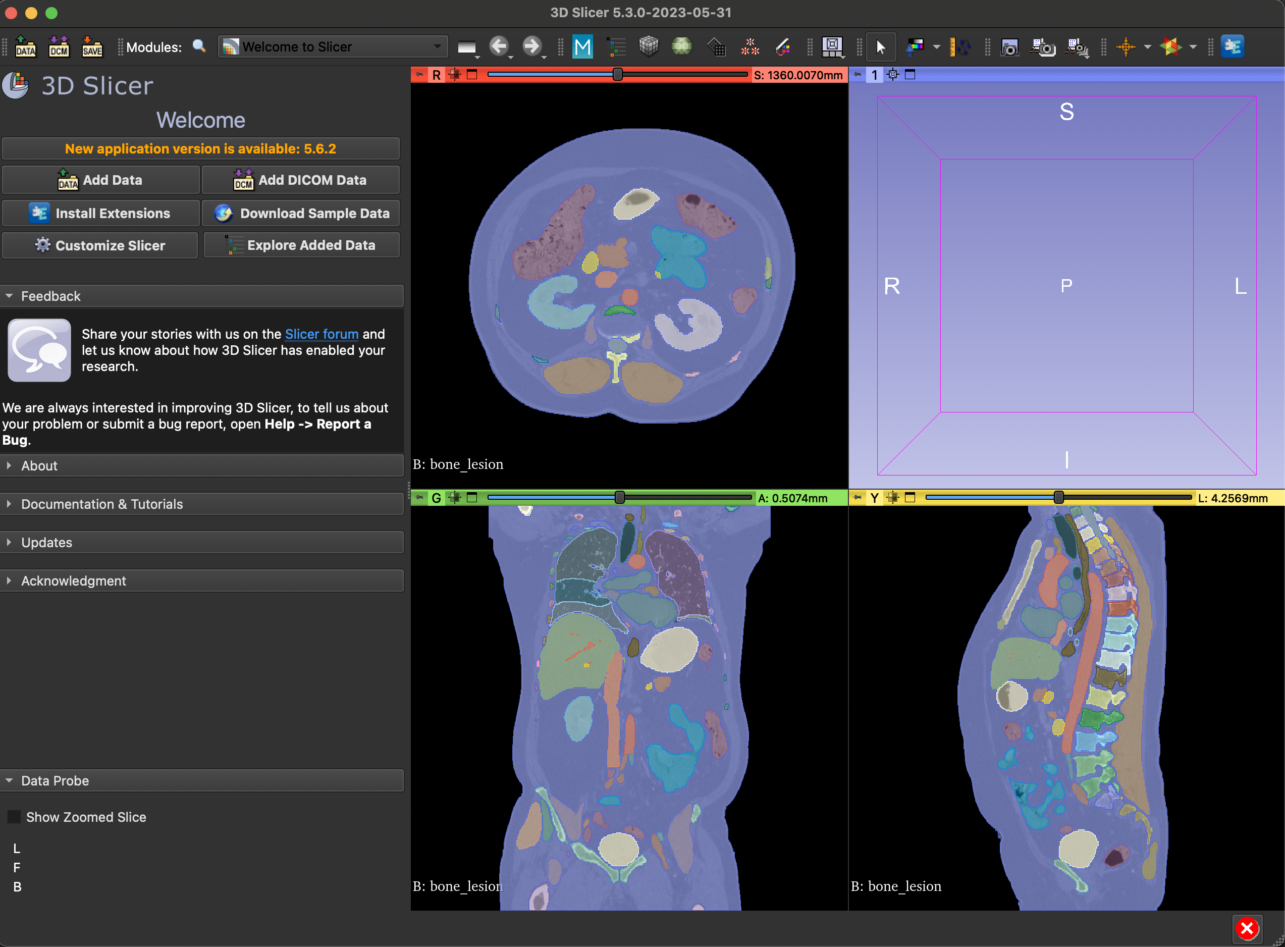 3D Slicer Rendering Example 4