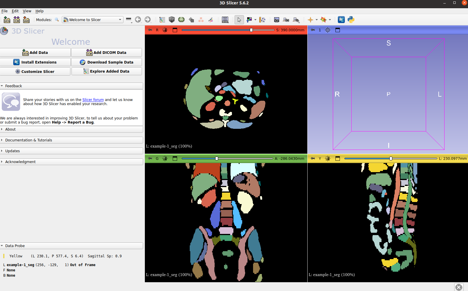 3D Slicer Rendering Example 4